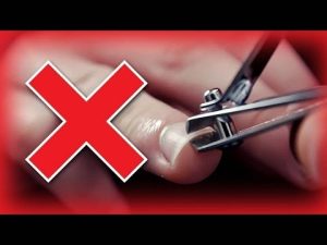 Δες γιατί πρέπει να σταματήσεις να κόβεις λάθος τα νύχια σου! (video)