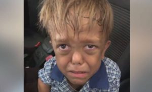 Αγόρι – νάνος κλαίει με λυγμούς λόγω σχολικού bullying: «Θέλω να αυτοκτονήσω» (video)