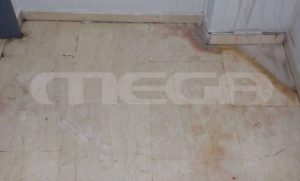 Επίθεση με βιτριόλι: Νέα ντοκουμέντα πριν τη δίκη – Αποκάλυψη για το καυστικό υγρό