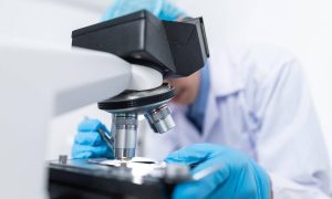 Ευλογιά των πιθήκων: Συναγερμός για ύποπτο κρούσμα στη Θεσσαλονίκη