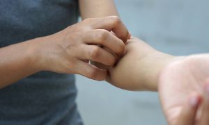 Σοβαρές παθήσεις που εκδηλώνονται με δερματικά συμπτώματα (εικόνες)