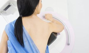 Μαστογραφία: Γιατί και πόσο πρέπει να απέχει από το εμβόλιο κατά της Covid-19