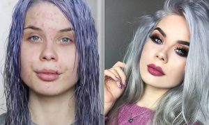 Make up artist αποκαλύπτει στο κοινό την πάθηση στο δέρμα της και τι κάνει με αυτό