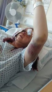 Αυτοκίνητο παρέσυρε πεζό και την έριξε μέτρα μακριά (video)