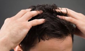 Πιτυρίδα: Τρεις σπιτικές λύσεις, με την υπογραφή των δερματολόγων!