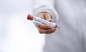 self-testing.gov.gr: «Έκανα το self test και βγήκε θετικό; Τι πρέπει να κάνω»