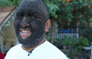 Θα πάθετε σοκ! Αυτός είναι ο πιο τριχωτός άνδρας στον κόσμο. Τον φωνάζουν λυκάνθρωπο (video)