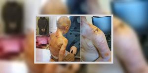 Αίσχος! Πατριός έδειρε με τη ζώνη 4χρονη γιατί δεν μπορούσε να μετρήσει (video)