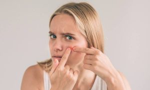 Έβγαλες σπυράκι; Δες πώς θα το εξαφανίσεις με φυσικό τρόπο