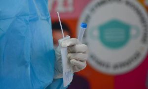 Κρούσματα σήμερα: Η ανακοίνωση του ΕΟΔΥ για τα κρούσματα την Κυριακή 27 Δεκεμβρίου 2020
