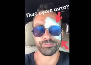 Survivor: Ποιος… βούλωσε το μάτι του Σάκη Τανιμανίδη; (Video)