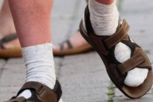 Η «εκδίκηση» του Γερμανού τουρίστα – Στη μόδα το σανδάλι με κάλτσα (photos)
