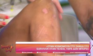 Survivor: Η Σοφιάννα δείχνει τα τραύματα της