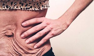 Body shaming: Δείχνει την κοιλιά της και στέλνει ένα δυνατό μήνυμα