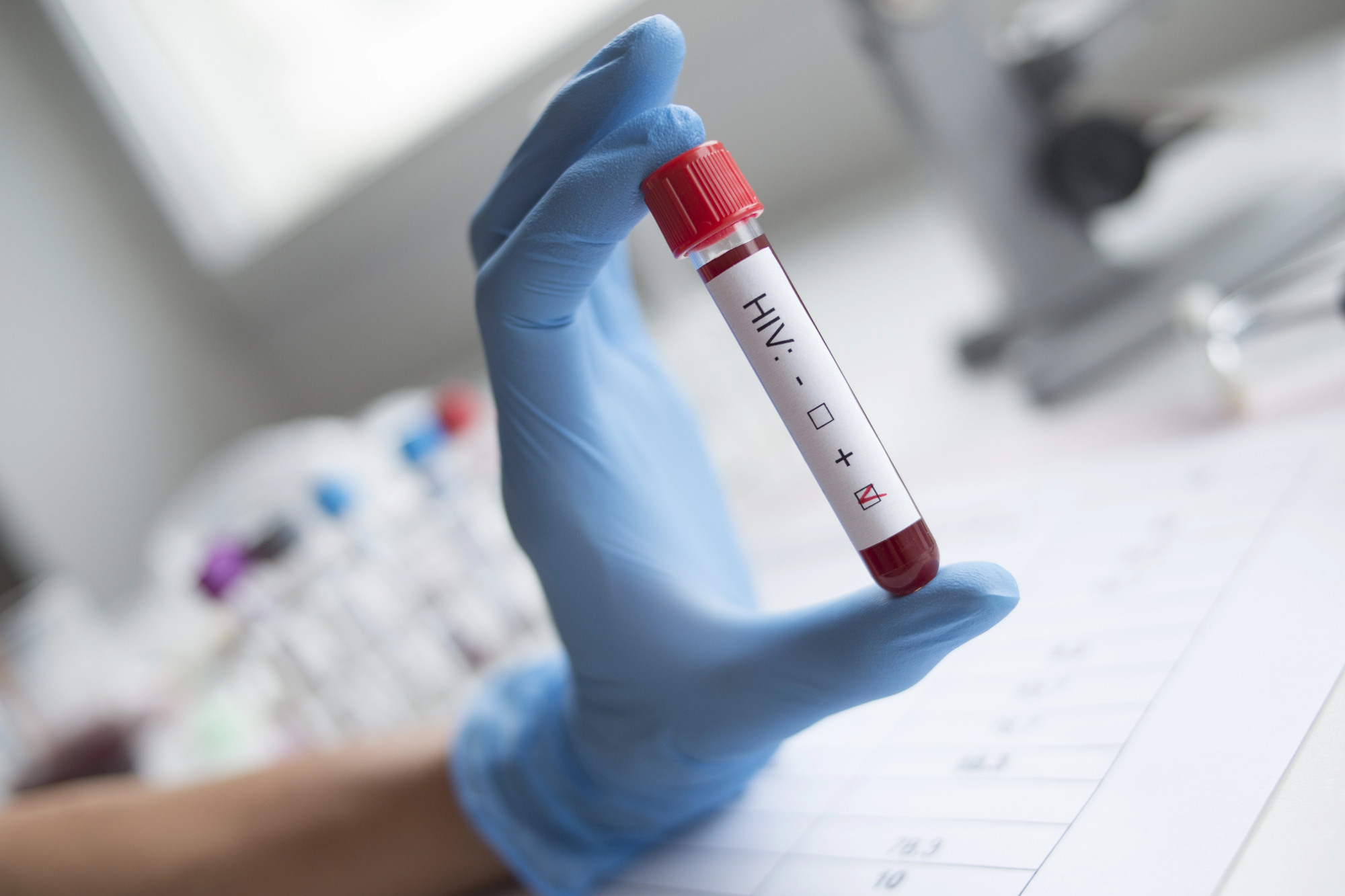 Εμβόλιο κατά του HIV, επίτευγμα της χρονιάς για το Science...